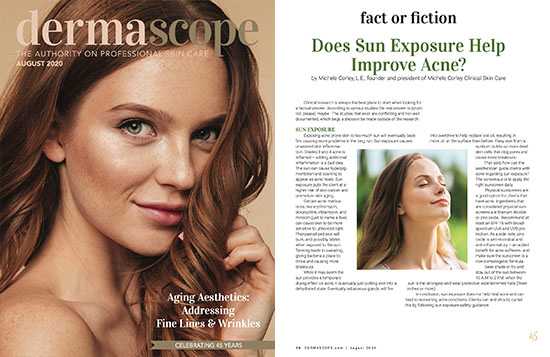 Dermascope magazine cover and Does Sun Exposure Help Improve Acne article page